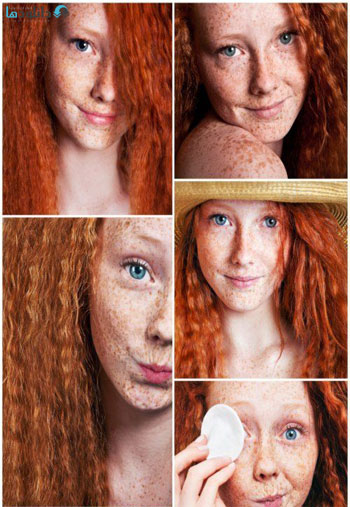 Beautiful-freckled-young