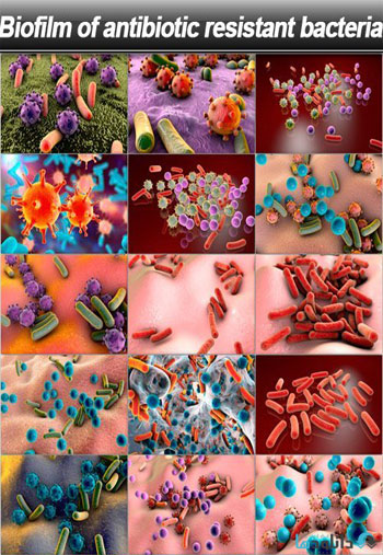 استوک-Biofilm-of-antibiotic
