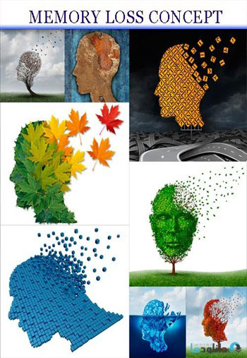 استوک-Memory-Loss-Concept