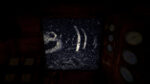 تصاویر-بازی-Iron-Lung